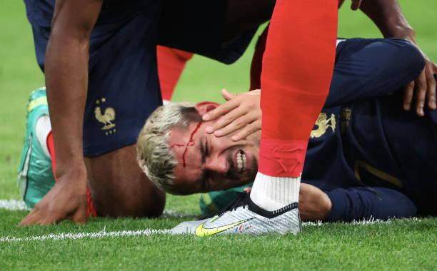 开云体育五大联赛-姆皇破法国纪录，54球平哈兰德！“小公主”挂哨抢戏